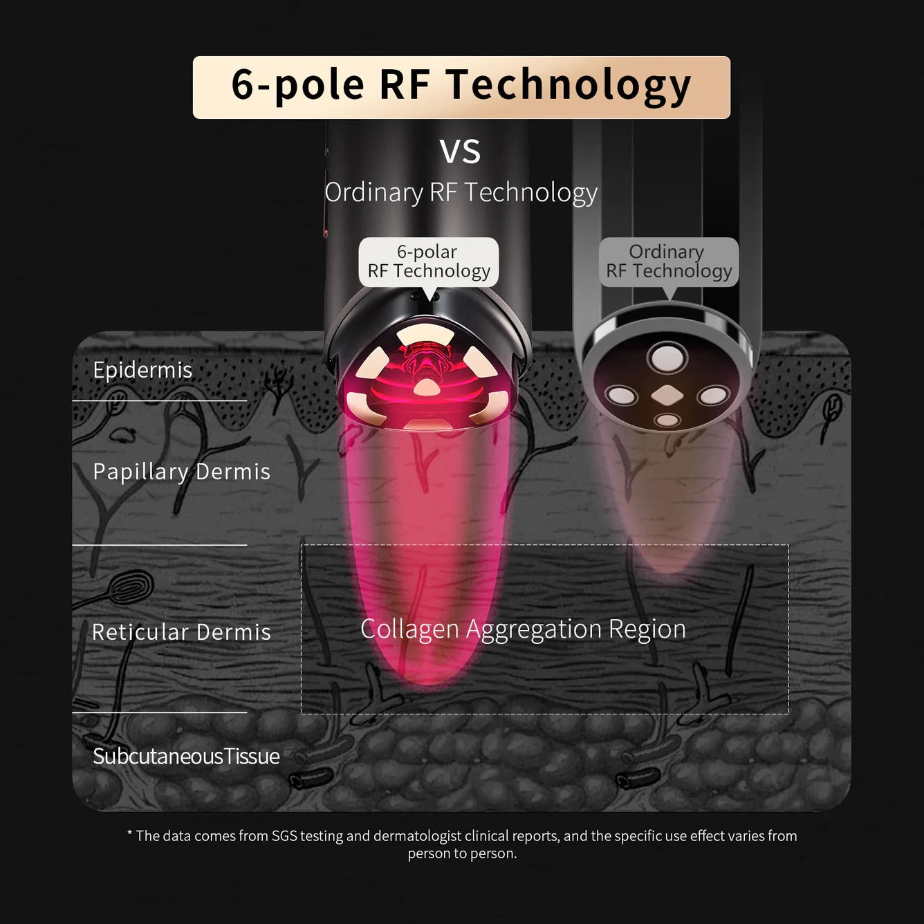 Rong Yi Rn Face Lift Firming Rejuvenation Import Instrument Backlight